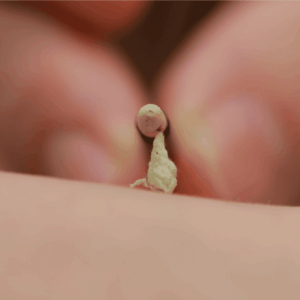 よもぎ栽培長野県